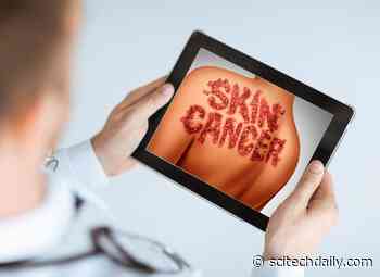 Experts Warn: Skin Cancer Diagnosis Apps Are Unreliable and Poorly Regulated