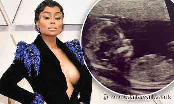 Blac Chyna posts then quickly DELETES an ultrasound photo leaving fans reeling over pregnancy buzz