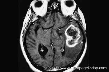 Data Favor Max Resection for All Glioblastomas