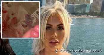 Chloe Ferry's hotel room smeared with blood after gruesome holiday accident in Dubai
