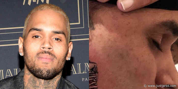 Chris Brown Debuts Face Tattoo of an Air Jordan Sneaker!