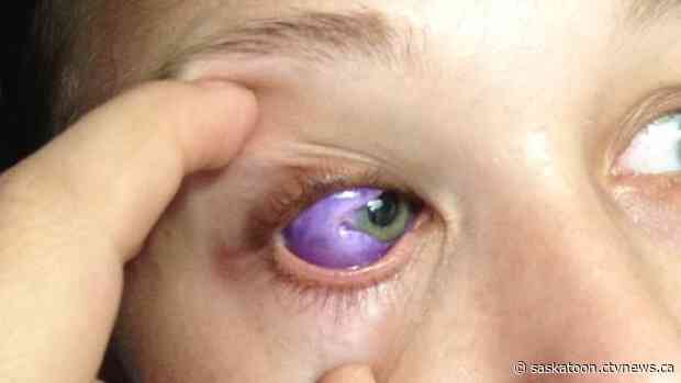 Sask. optometrists approve government's decision to ban eye tattooing