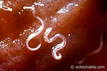 Cracking the Code for Hookworm Infestation – Providing New Hope for a Vaccine