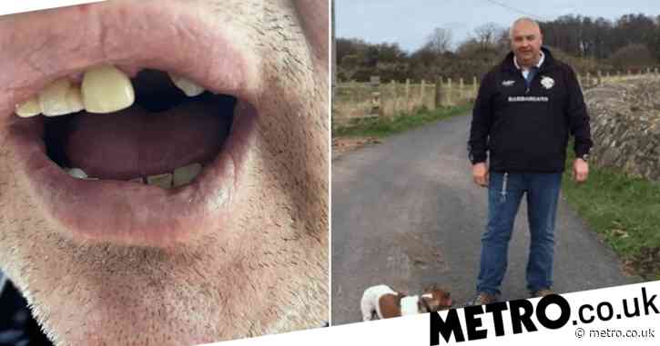 Owner loses tooth biting Rottweiler to stop it attacking his dogs