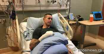 Man seeking answers after finger severed at indoor trampoline park in southeast Calgary