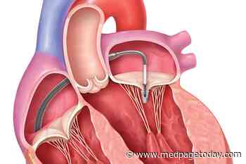 Requirements Questioned for TAVR, MitraClip Centers