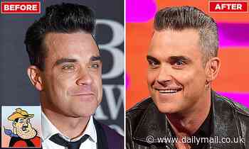 Robbie Williams admits cosmetic work on his chin left him looking like Desperate Dan