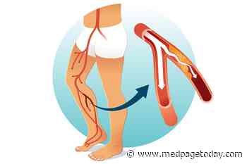 Room for More Revascularization, Statin Use in Critical Limb Ischemia