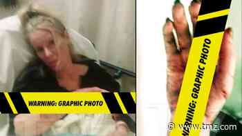 'Beverly Hills Cop' Actress Heather Parkhurst Mauled by Her Pit Bulls