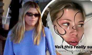 Sofia Richie heads out for lunch with friends after getting surgery to remove wisdom teeth 