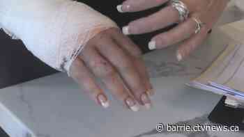 ‘It looked like a murder scene’: Barrie realtor attacked by dog at house showing