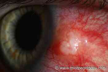 What Is Causing These Disturbing Changes in a Young Woman's Eye?
