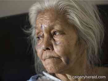 Attacker returns to save Edmonton senior after setting her house on fire - Calgary Herald