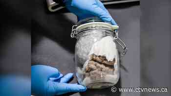 Human brain mailed from Toronto to Wisconsin seized at U.S. border