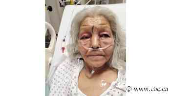 'I said my prayer to God': N.W.T. elder recalls Edmonton axe attack