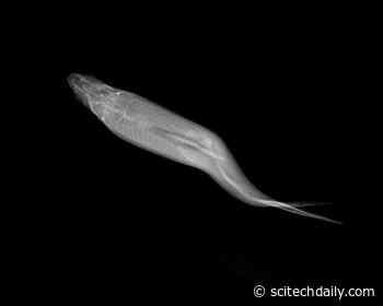 How Ear Bones of a Fish Unraveled the Mystery of Spinal Deformities