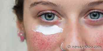 14 products dermatologists recommend for soothing redness and rosacea