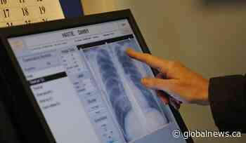 Diagnostic imagery ordered by chiropractors, physios won’t be covered in Alberta