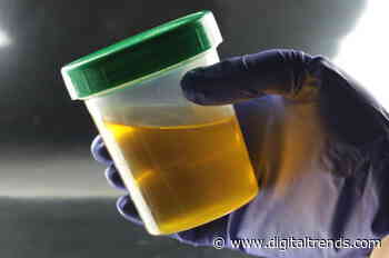 Urine test could detect bladder cancer traces 10 years before other signs appear