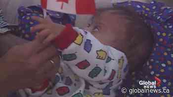 Toddler needed life-saving surgery 20 years ago and Edmonton stepped up