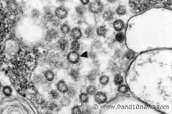 Global Medical Supply Could Be Impacted By Coronavirus - 9&10 News