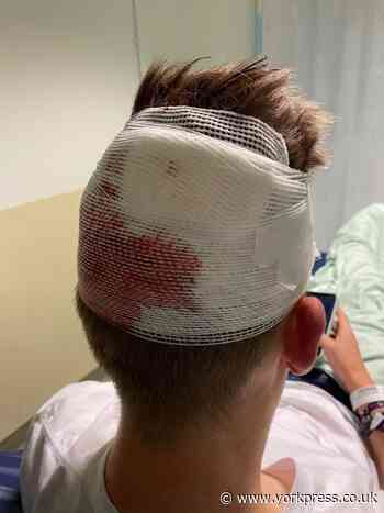 Mum wants to trace anyone who helped  her unconscious son at York station