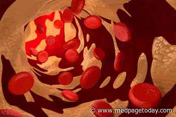 LDL Equation May Be Due for Accuracy Upgrade