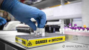 How A Coronavirus Blood Test Could Solve Some Medical Mysteries - KPBS