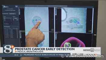 Medical Breakthroughs - Early detection of prostate cancer - News8000.com - WKBT