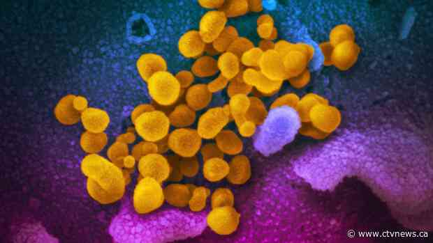 Man in Washington state first in U.S. to die from new virus