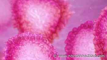 Rhode Island DOH Confirms First Positive Case of Coronavirus - NBC Connecticut