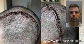 Thug jailed after leaving victim with life threatening brain injuries in nightclub attack