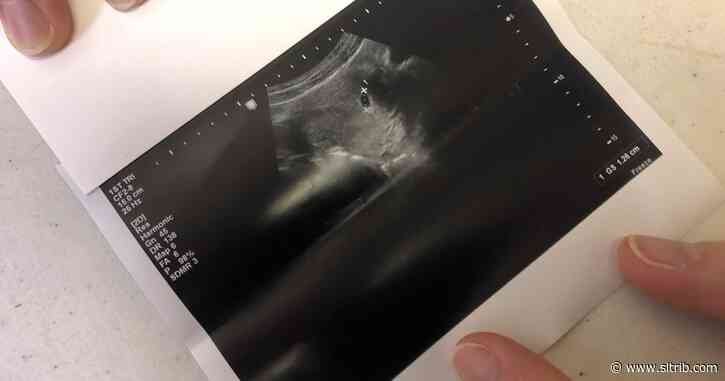 Pre-abortion ultrasound mandate progresses to Utah House