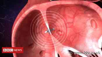 Computer inside the heart aims to aid treatment