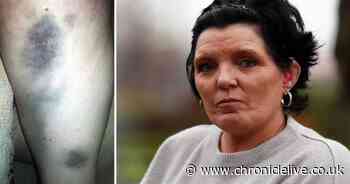 Police quiz woman over attack on deaf grandmother enjoying a charity bingo night in Blakelaw