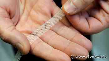 Women with transvaginal mesh implants to share $21.5 million in settlement