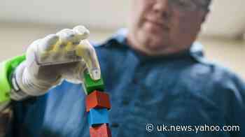 Amputees use thought to move individual fingers in bionic limb