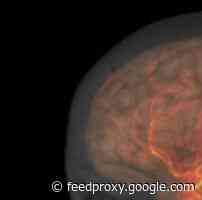 Misplaced Priorities? We’re Studying “The Brain” But Not People