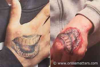 Matching tattoos focus of last day of testimony in Orillia murder case - OrilliaMatters.Com