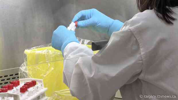 2 more Albertans have died from influenza, health officials report