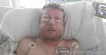 See how horrific attack in Wallsend left man 'unrecognisable'