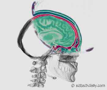Highly Detailed Images of the Human Brain Using Revolutionary Seismic Imaging Technology