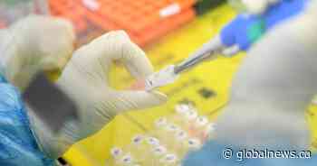 Coronavirus: Alberta plans for expanded testing capacity and assessment centres