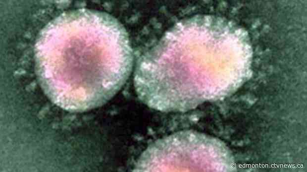 2 new presumptive cases of COVID-19 in Alberta