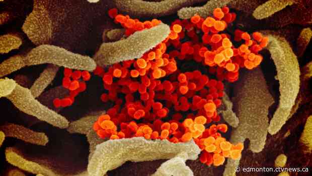 Alberta confirms 7 COVID-19 cases, officials planning for 'new normal' in coronavirus world