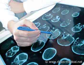 Virtual reality could aid in early detection of MS balance problems