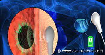 Future medical implants could be charged through the skin using sound