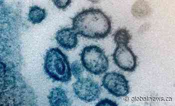 Alberta coronavirus cases jump to 19, one patient visited Edmonton hospital before testing positive