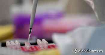 Toronto hospital to open coronavirus screening centre at medical office in East York - Global News