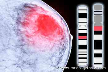 Breast Cancer Gene Screening Criteria May Need New Look